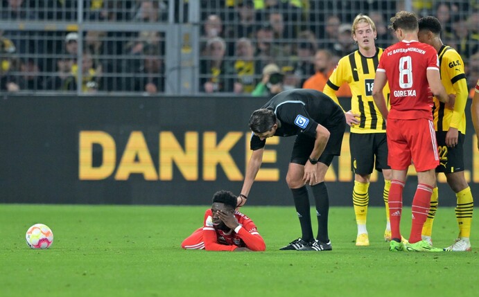 Bayerns Alphonso Davies wurde im Spiel bei Borussia Dortmund von Jude Bellingham am Kopf getroffen.