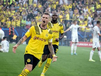 BVB-Kapitän Marco Reus steht nach seiner Außenbandverletzung vor dem Comeback. BVB-Kapitän Marco Reus steht nach seiner Außenbandverletzung vor dem Comeback.