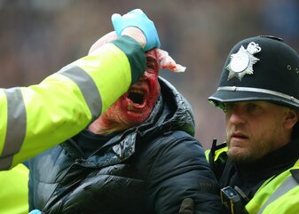 Beim Pokalspiel zwischen West Brom und Wolverhampton kam es zu hässlichen Szenen. Beim Pokalspiel zwischen West Brom und Wolverhampton kam es zu hässlichen Szenen.