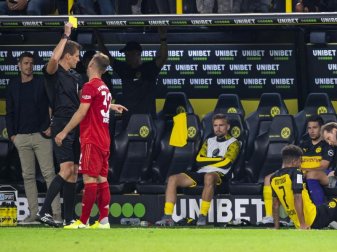 Gut bedient: Bayerns Joshua Kimmich sieht Gelb. Foto: Guido Kirchner Gut bedient: Bayerns Joshua Kimmich sieht Gelb. Foto: Guido Kirchner