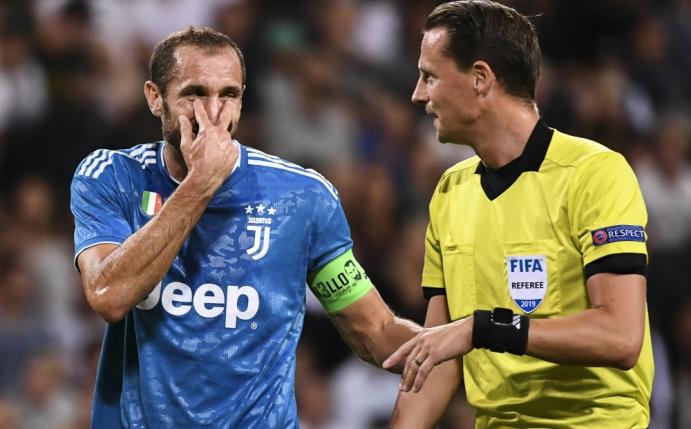 Chiellini zog sich eine Kreuzbandverletzung zu