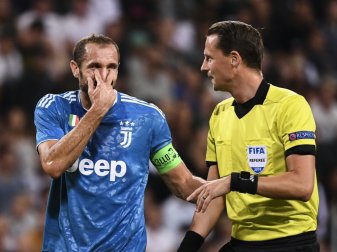 Chiellini zog sich eine Kreuzbandverletzung zu Chiellini zog sich eine Kreuzbandverletzung zu