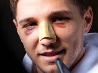 Niklas Stark zog sich in der Bundesliga einen Nasenbeinbruch zu. Foto: Federico Gambarini/dpa Niklas Stark zog sich in der Bundesliga einen Nasenbeinbruch zu. Foto: Federico Gambarini/dpa