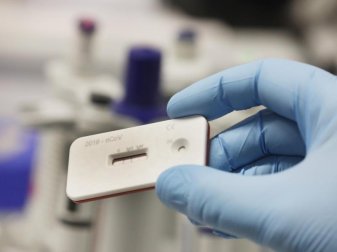 Die DFLiga rechnet angeblich mit einem Bedarf von 25.000 Coronavirus-Tests. Foto: Bodo Schackow/dpa-Zentralbild/dpa