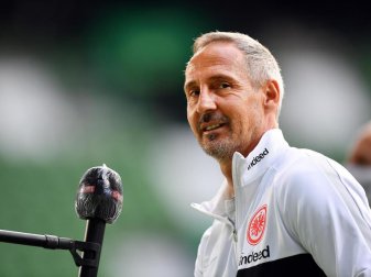 Will den Eintracht-Kader etwas verkleinern: Frankfurts Trainer Adi Hütter. Foto: Stuart Franklin/Getty Images Europe/Pool/dpa Will den Eintracht-Kader etwas verkleinern: Frankfurts Trainer Adi Hütter. Foto: Stuart Franklin/Getty Images Europe/Pool/dpa
